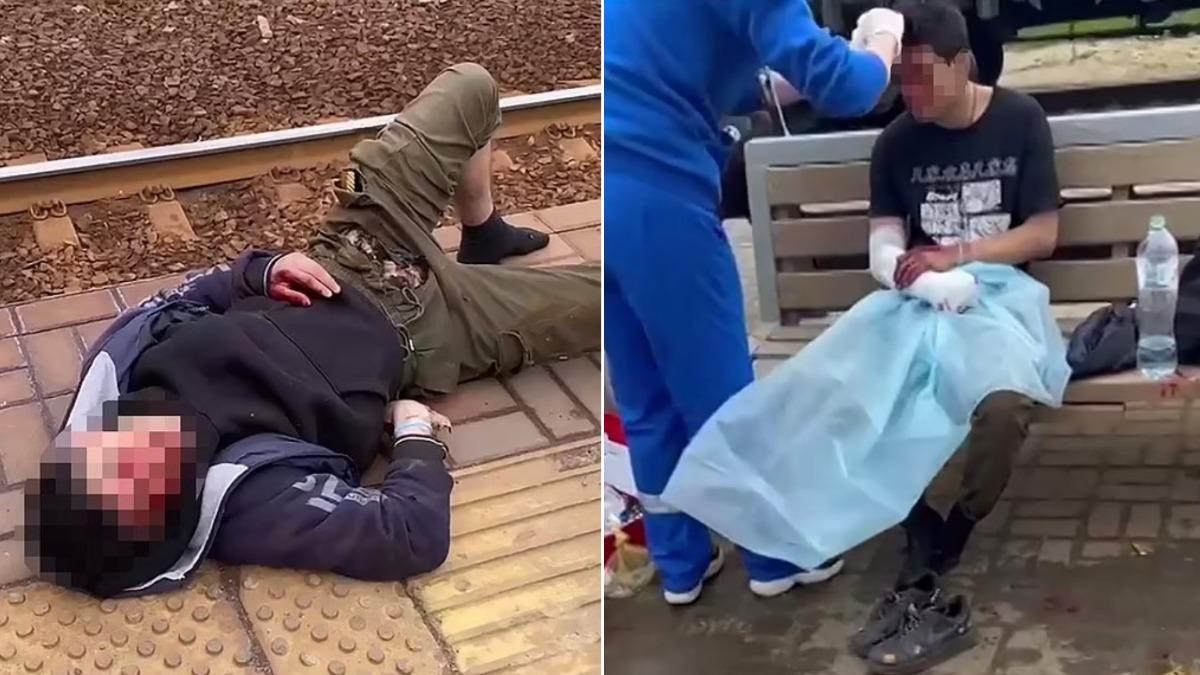 [新聞] 俄15歲少年跟風爬火車頂拍片　下體觸電